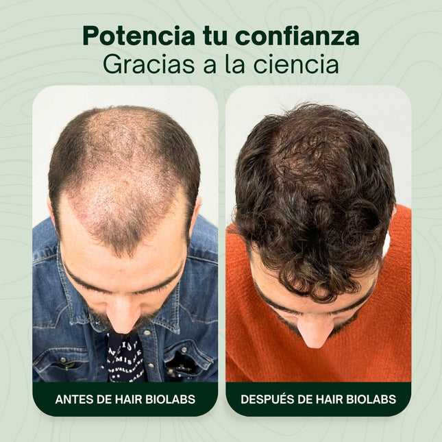 SUPER COMBO: Serum Anticaida Capilar + Shampoo Fortalecedor de Foliculos