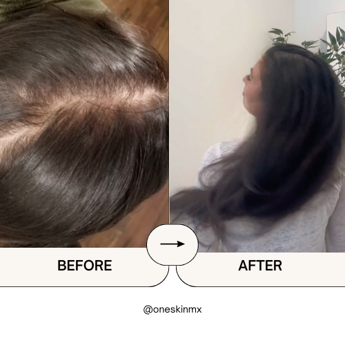 Crecilab-Activa el crecimiento natural con biotina y minoxidil.