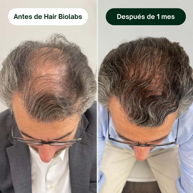 SUPER COMBO: Serum Anticaida Capilar + Shampoo Fortalecedor de Foliculos