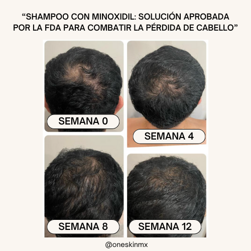 Crecilab-Activa el crecimiento natural con biotina y minoxidil.