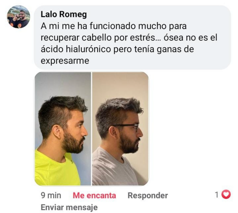 Crecilab-Activa el crecimiento natural con biotina y minoxidil.
