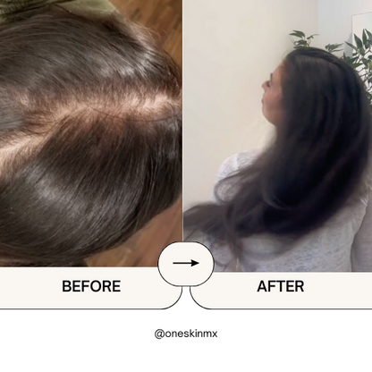 Crecilab-Activa el crecimiento natural con biotina y minoxidil.
