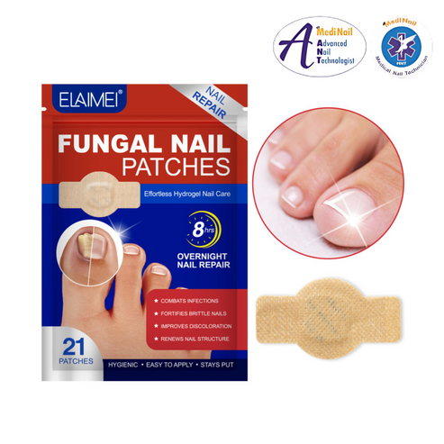 FUNGAL - Parches reparadores de uñas (x21 UNDS)