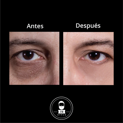 Roll On Anti-Ojeras-Reduce bolsas y ojeras de forma natural y visible.