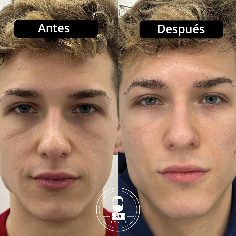 Roll On Anti-Ojeras-Reduce bolsas y ojeras de forma natural y visible.